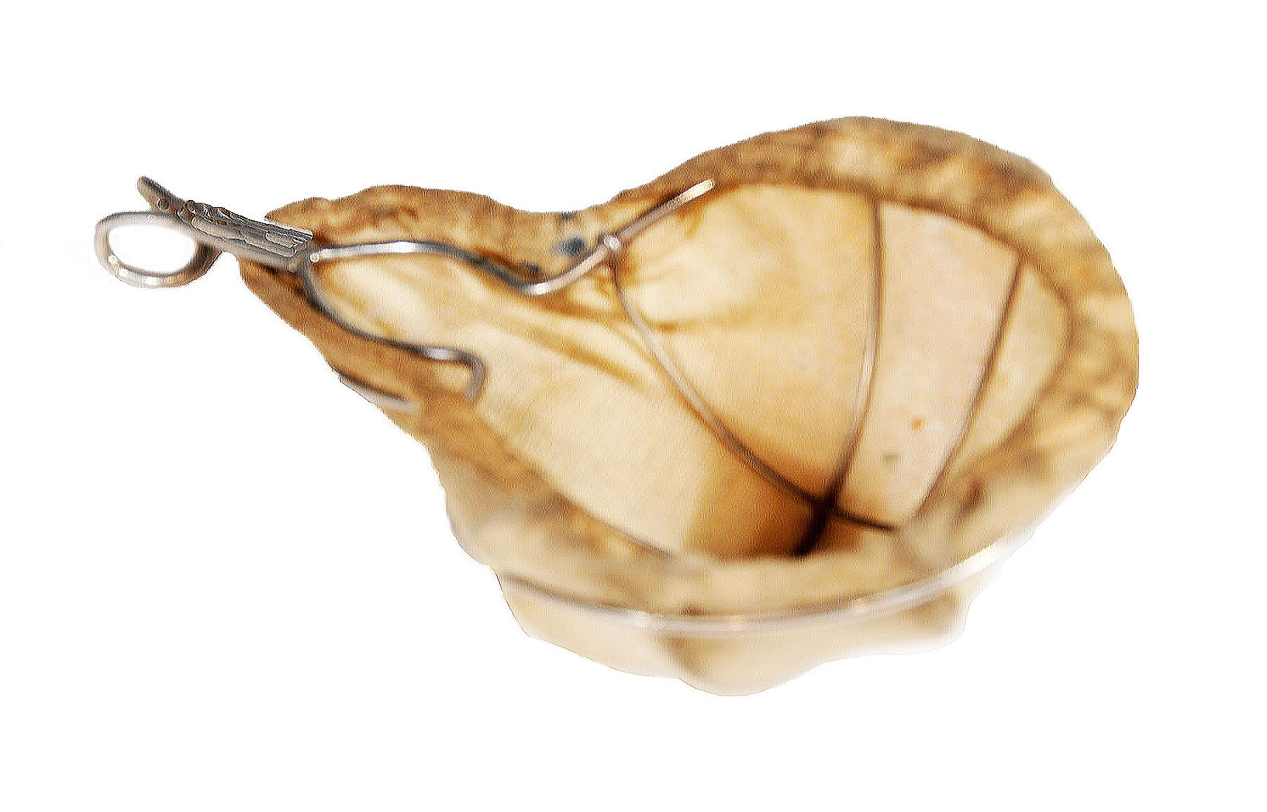 Magnified image for image #2