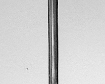 Photo of Walsh’s (stethoscope_drawing___mumie_080jpg)