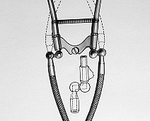 Photo of Lynch’s Folding (stethoscope_drawing___mumie_111jpg)